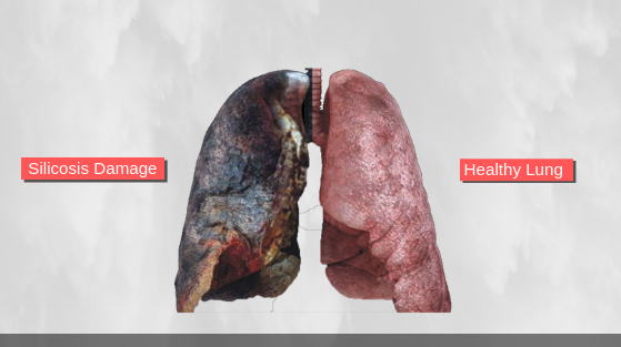 silica dust effects on lungs